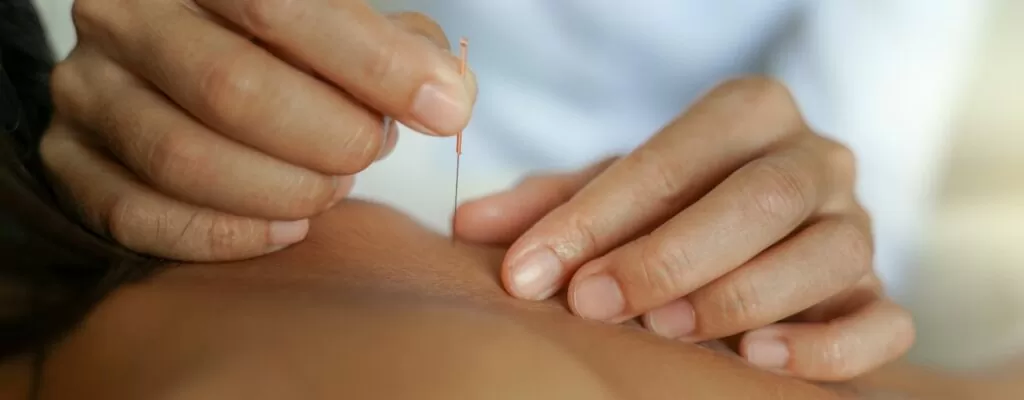 Dry Needling Integrated Physical Therapy Texas